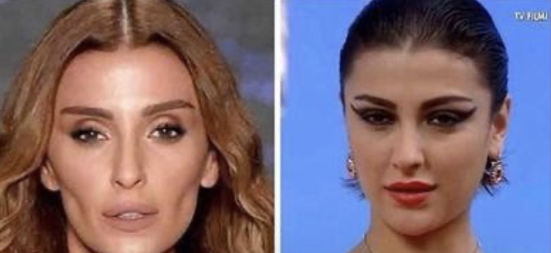 Özge Ulusoy�un yıllar önceki hali şoke etti!